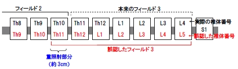 フィールド設定と放射線過線量照射部位