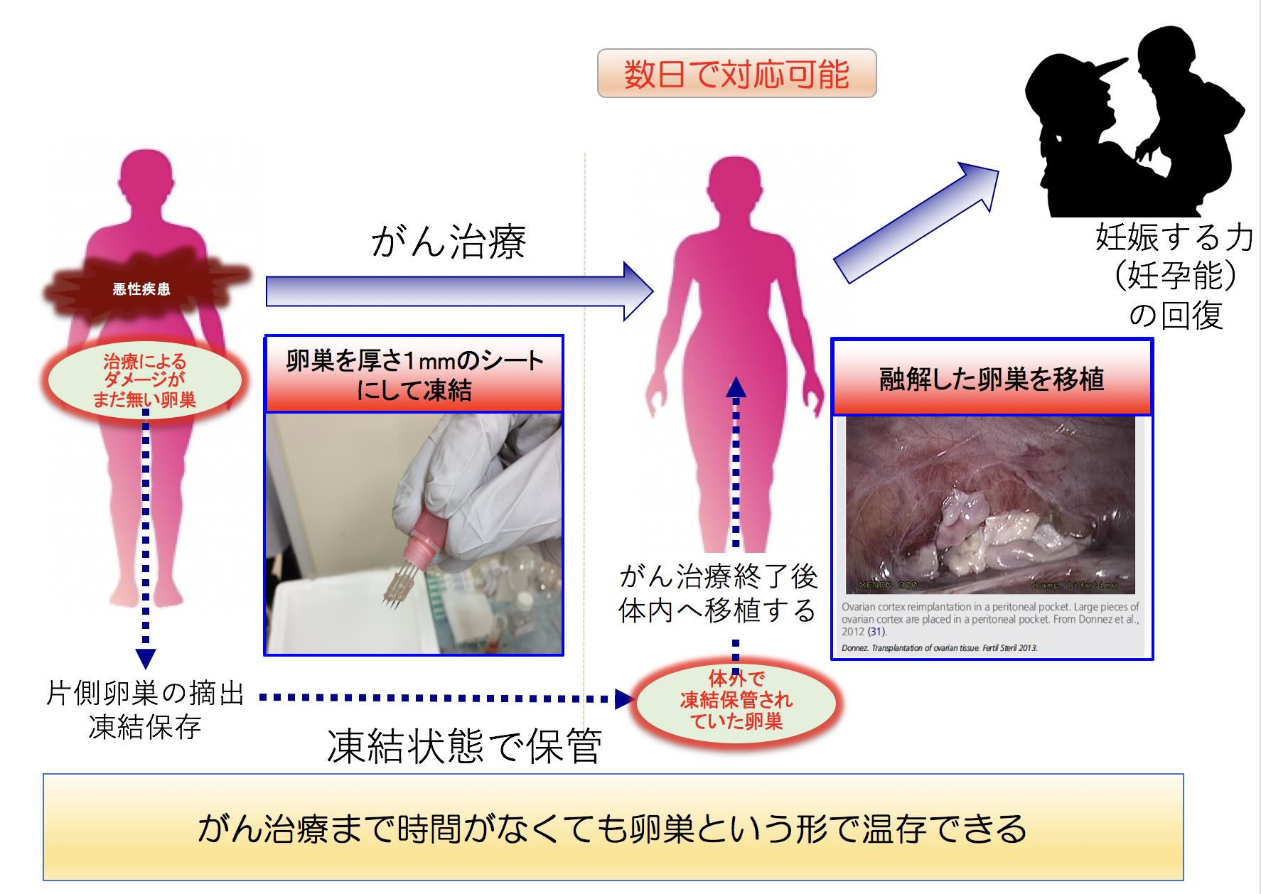 イメージ写真