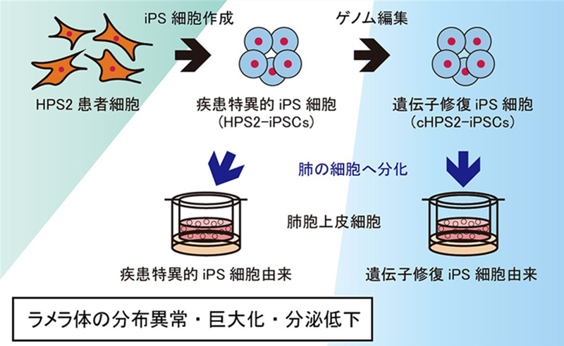 Ips細胞を用いて遺伝性間質性肺炎の病態解析に成功 間質性肺炎の原因究明の足がかりに 京都大学 Ips細胞を用いて遺伝性間質性肺炎の病態解析に成功 間質性肺炎の原因究明の足がかりに 京都大学