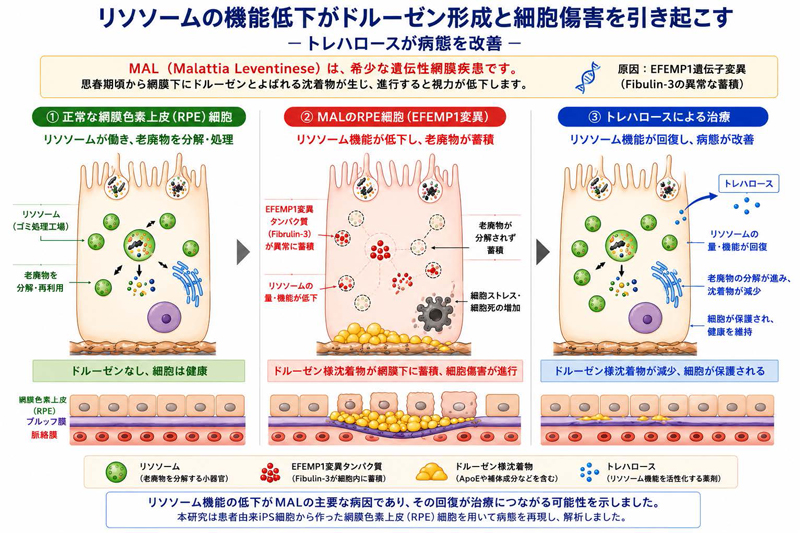 リソソーム異常が希少眼疾患の原因―iPS細胞で病態を解明、治療候補を
