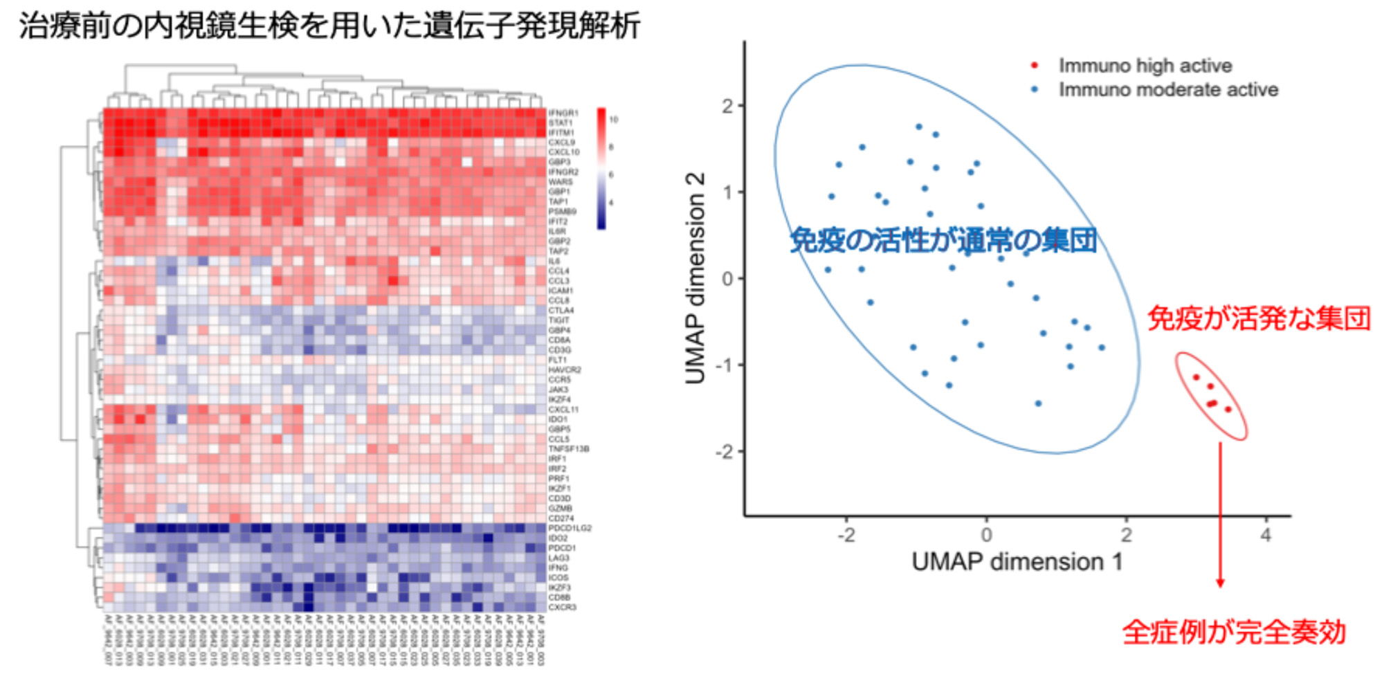 食道扁平上皮がんに対する根治的化学放射線療法と免疫チェックポイント